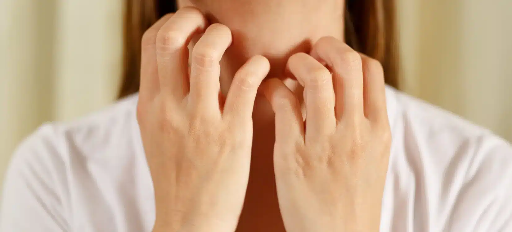 A close-up of a person experiencing an allergic reaction, scratching an itchy red rash on their neck.