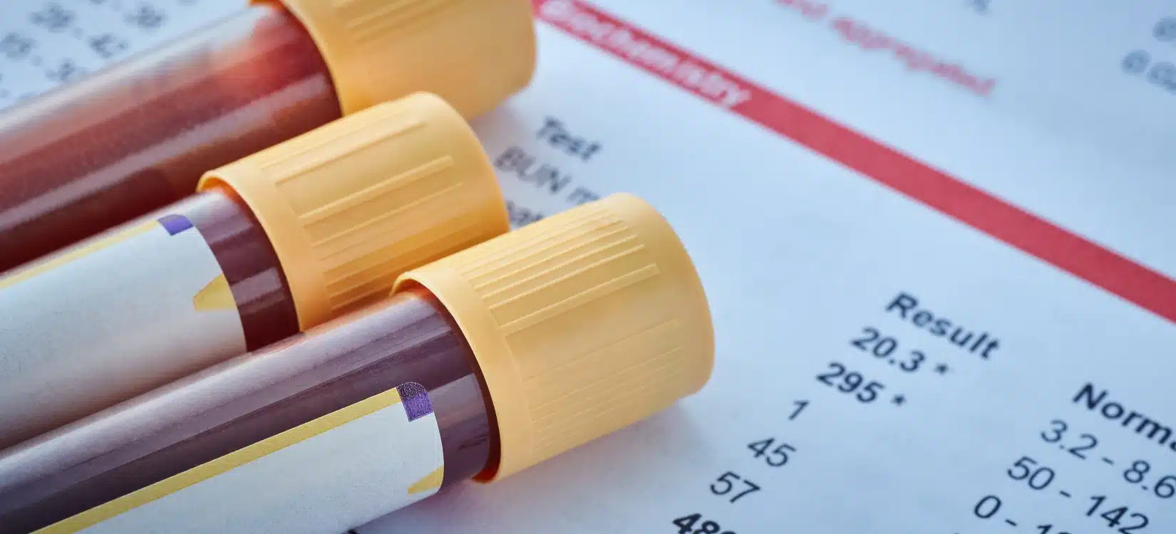 pots diagnosis blood volume blood test results